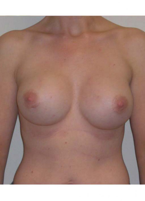 After Image