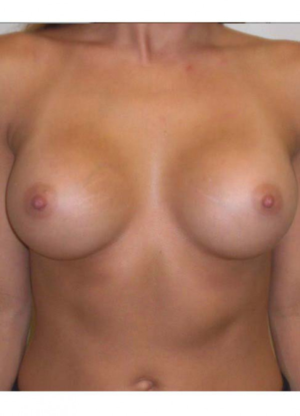 After Image