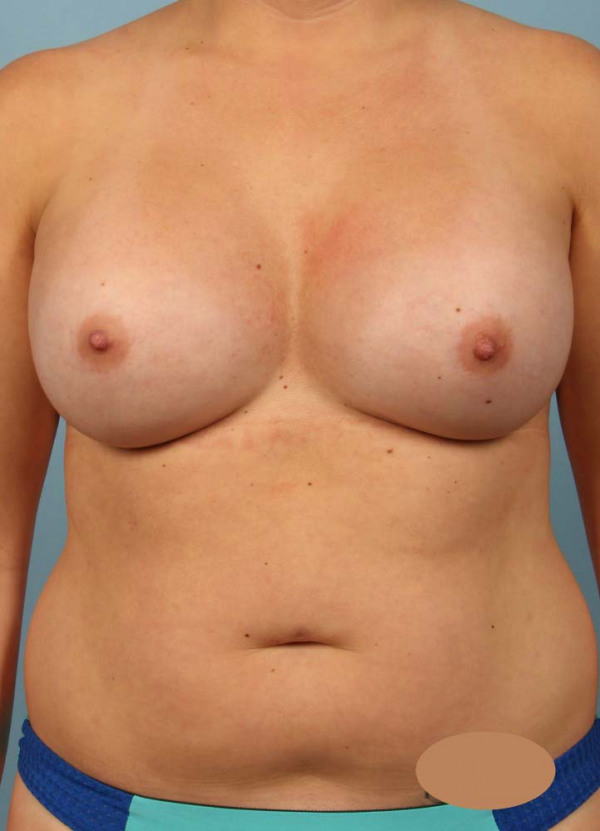 After Image
