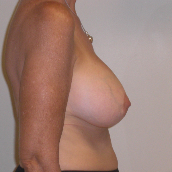 After Image