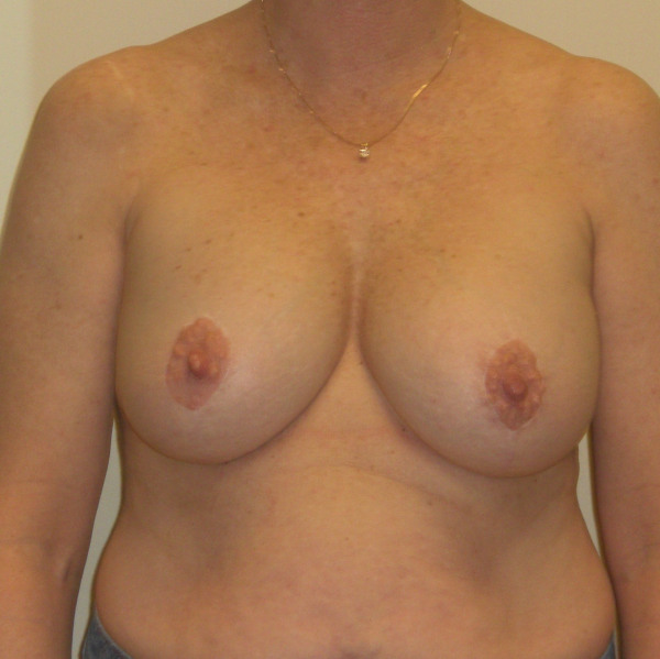 After Image