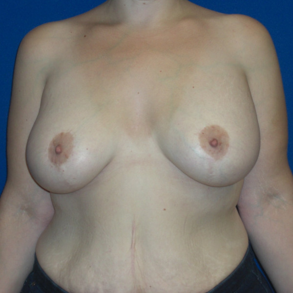 After Image