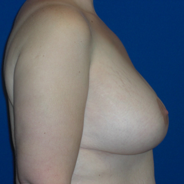 After Image