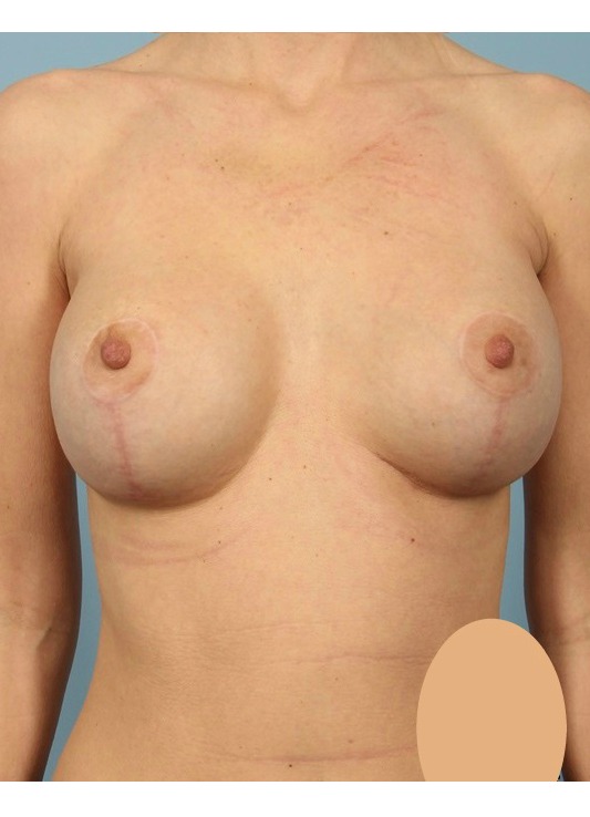 After Image