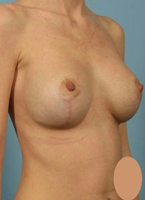 After Image