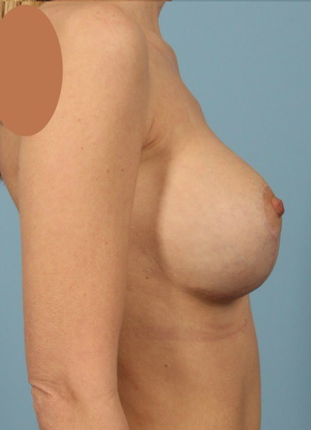 After Image