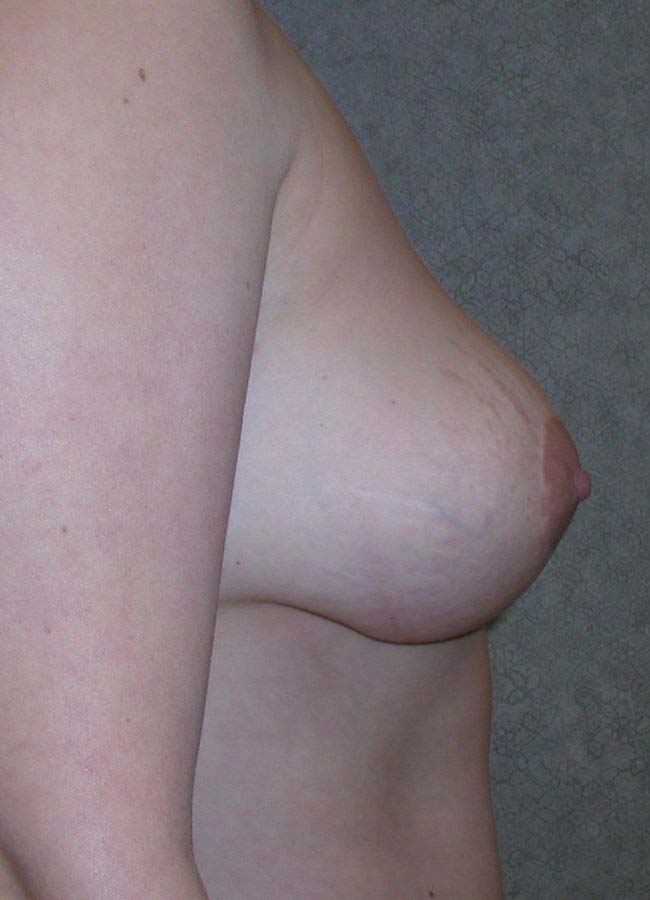 After Image