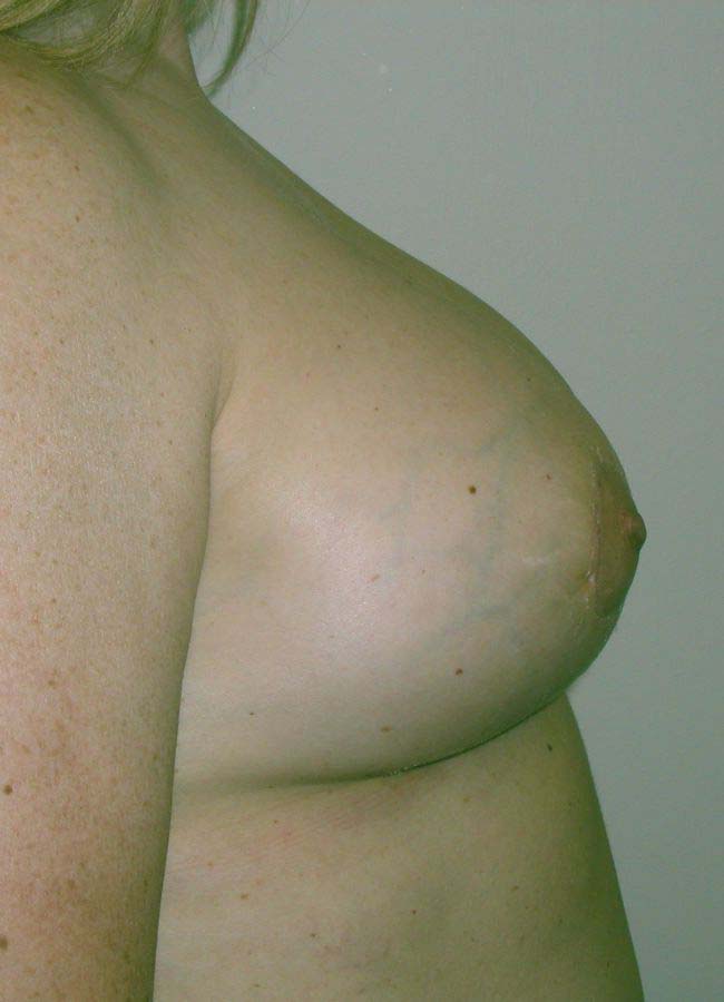 After Image