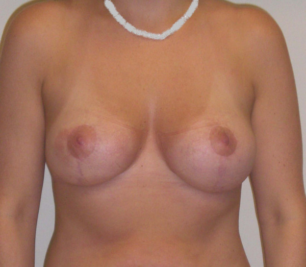 After Image