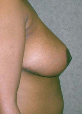 After Image