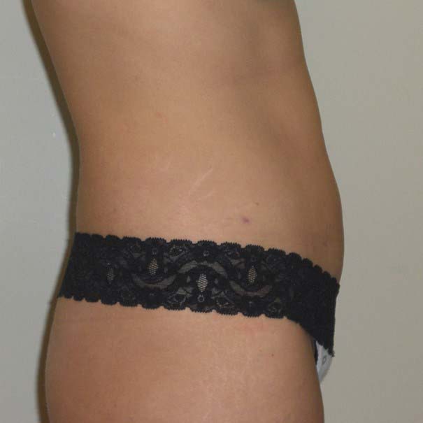After Image