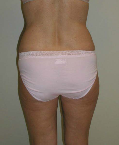 After Image