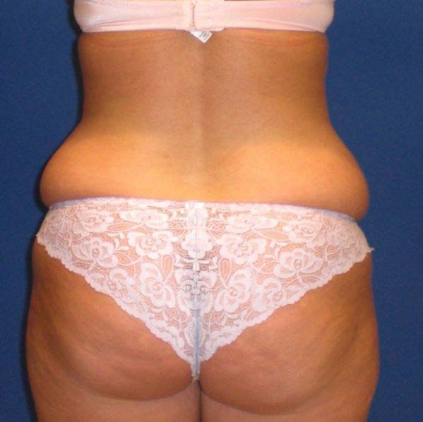 Before Image