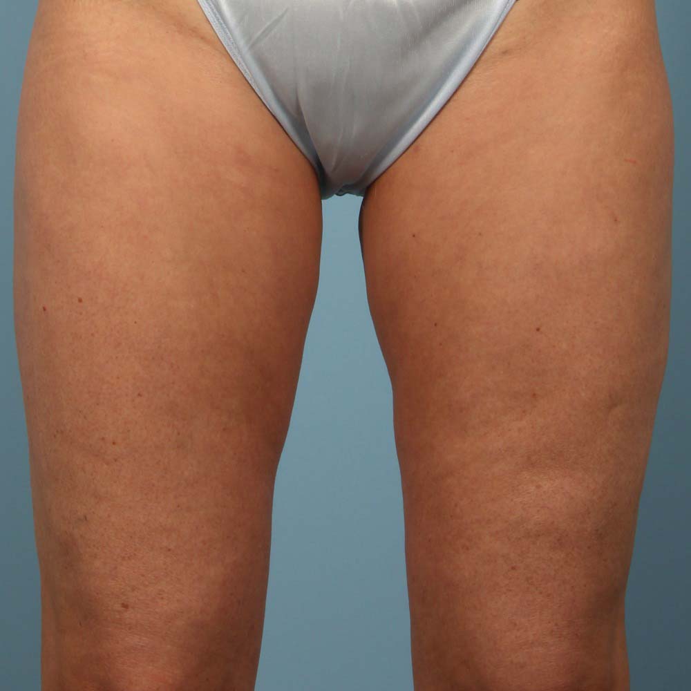 After Image