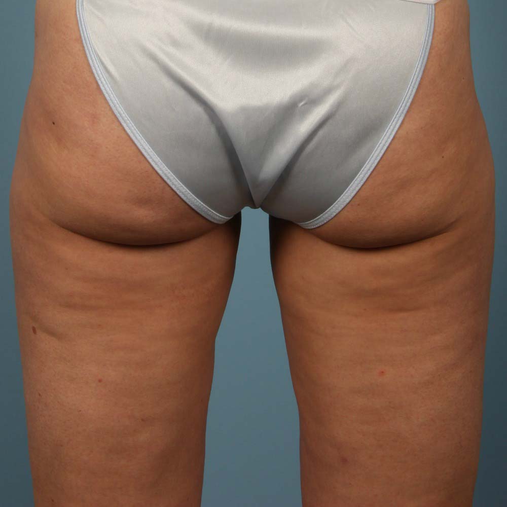 After Image