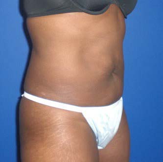 After Image