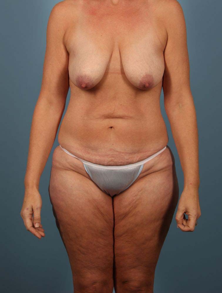 After Image
