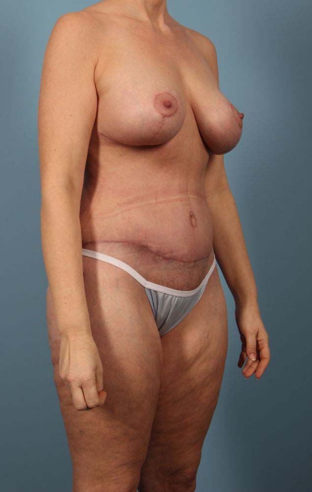 After Image