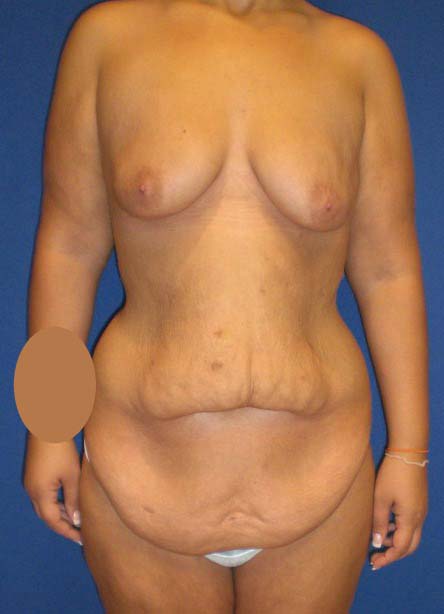 Before Image