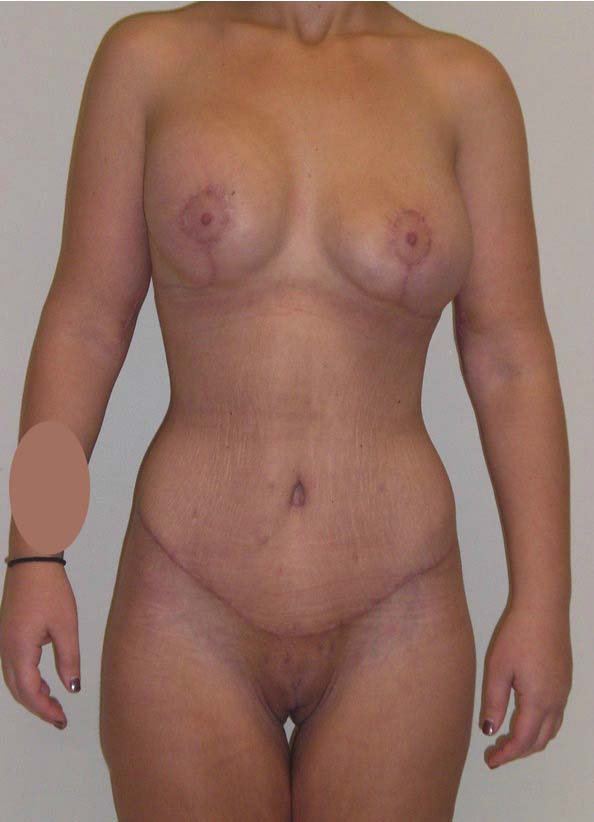 After Image