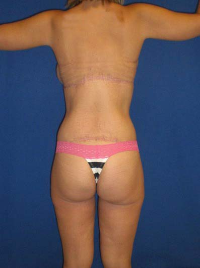 After Image