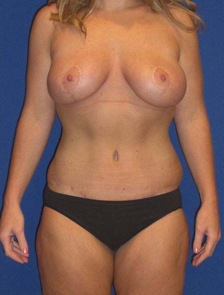 After Image