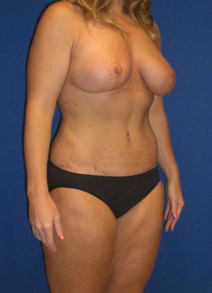 After Image