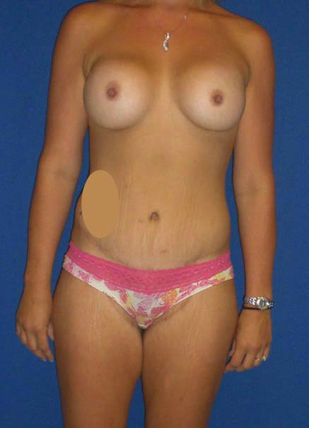 After Image