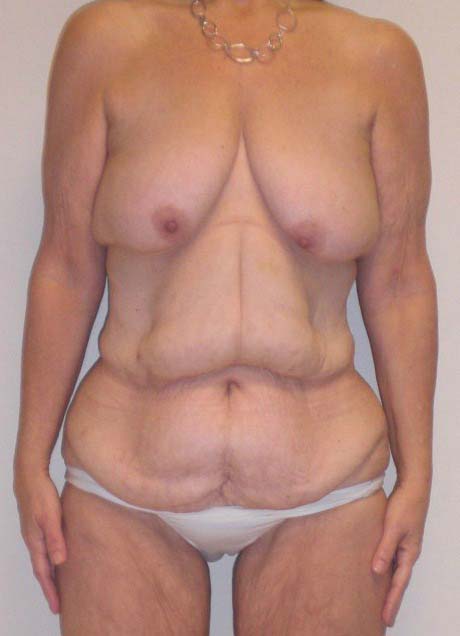 Before Image