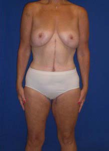 After Image