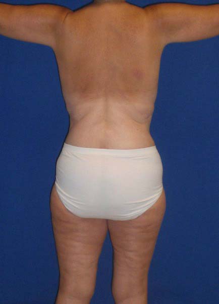 After Image