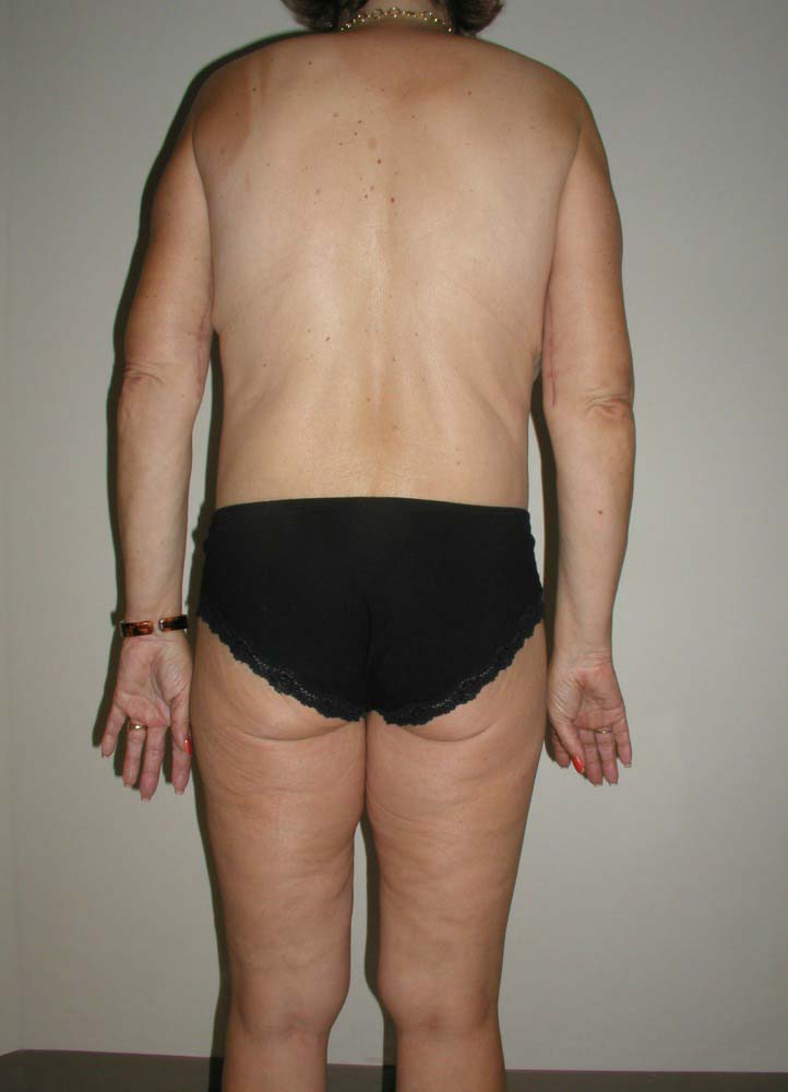 After Image