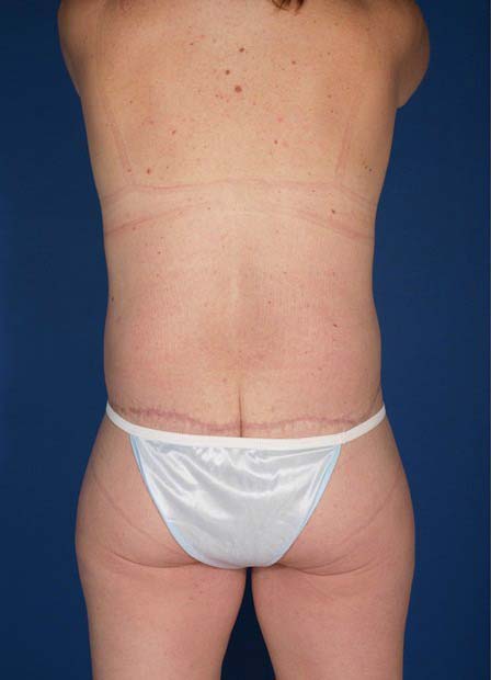 After Image