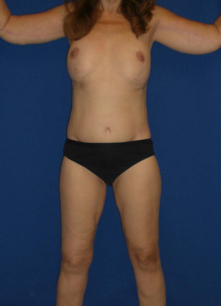 After Image