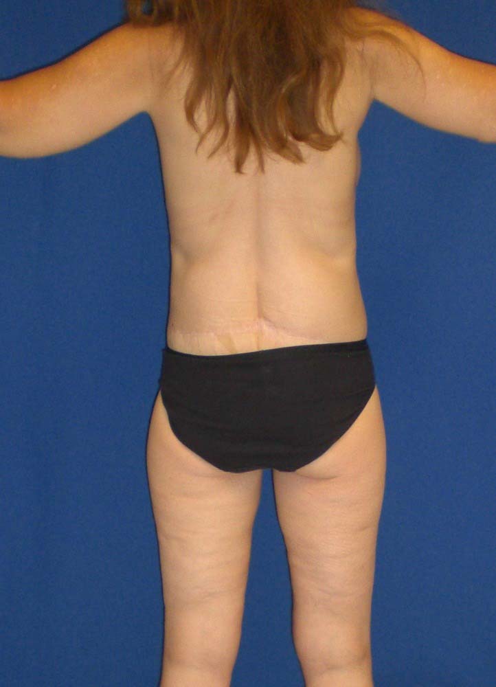 After Image