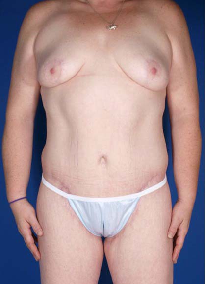 After Image