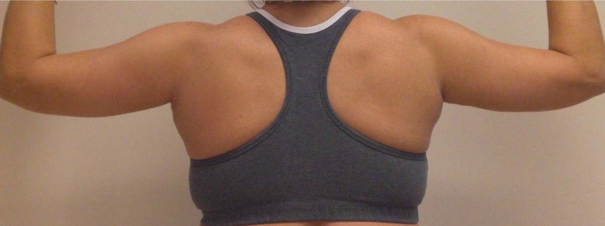 After Image