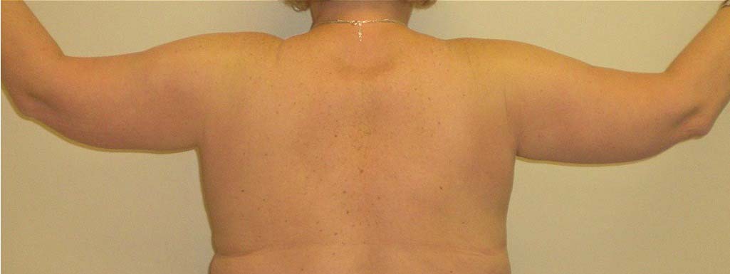After Image