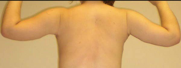 After Image