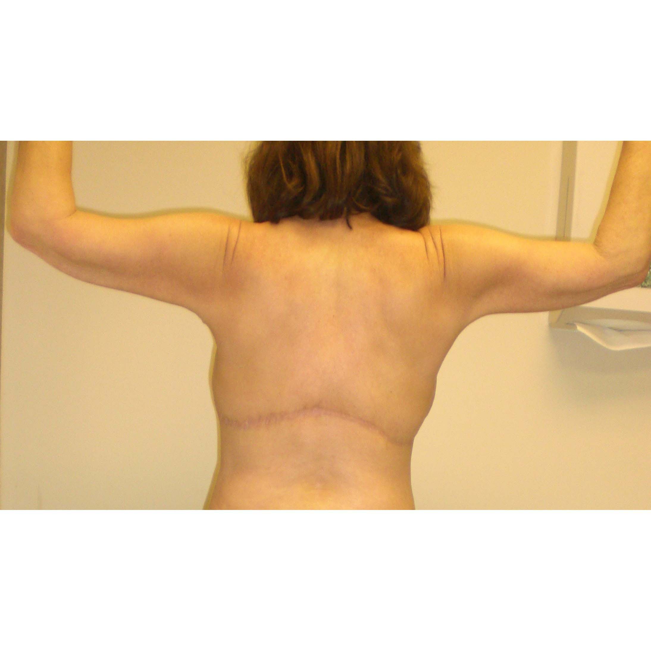 After Image