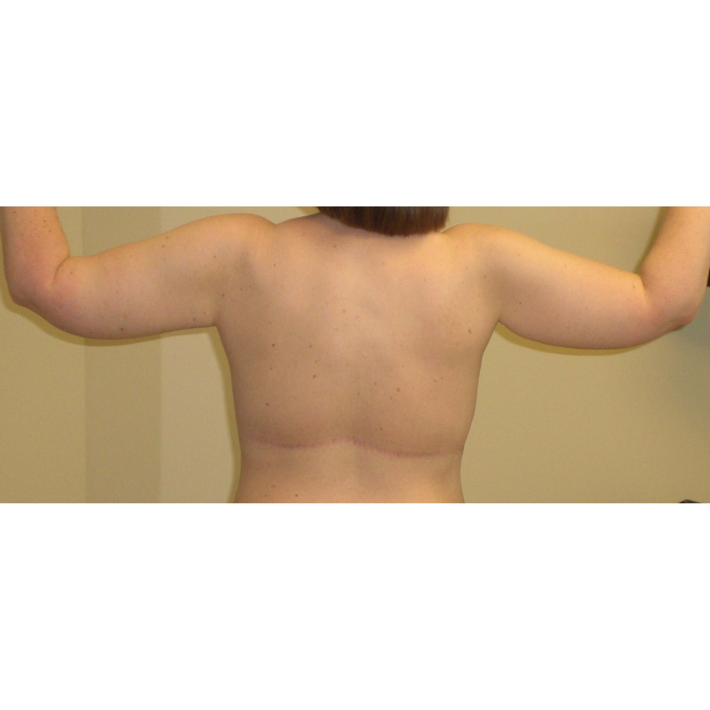 After Image