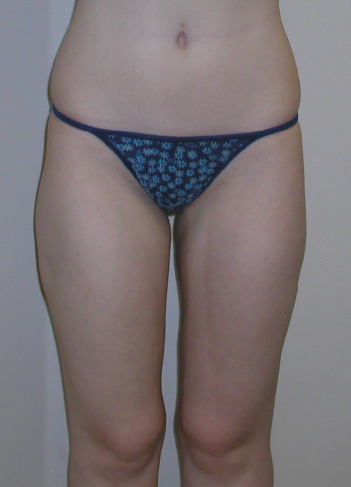 After Image