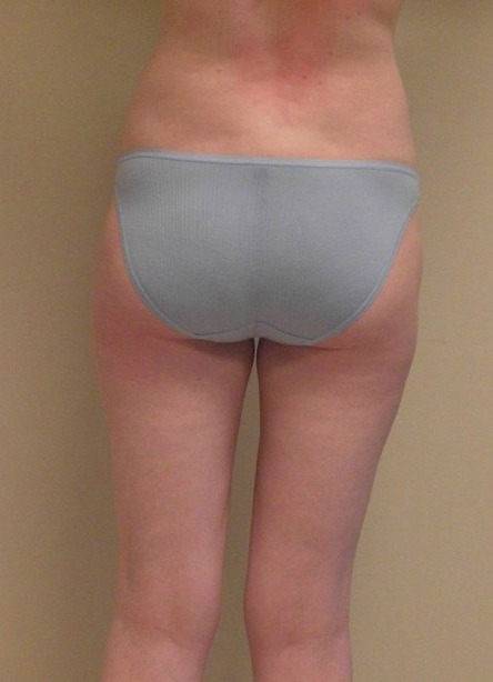 After Image