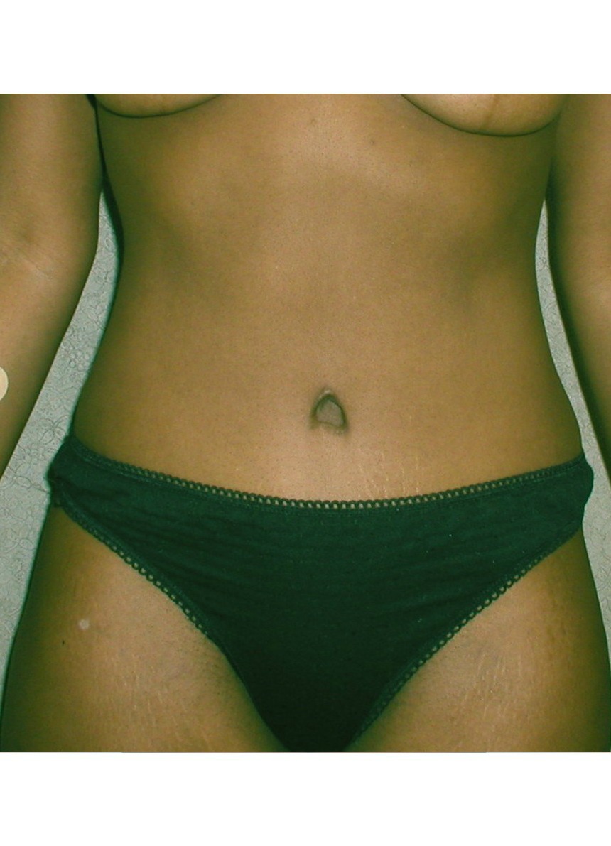 After Image