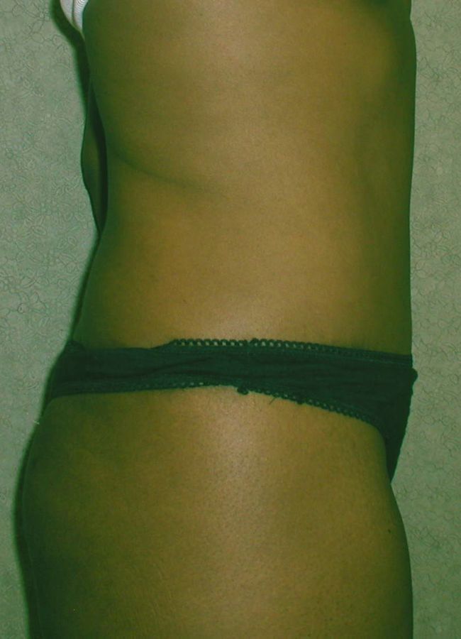 After Image
