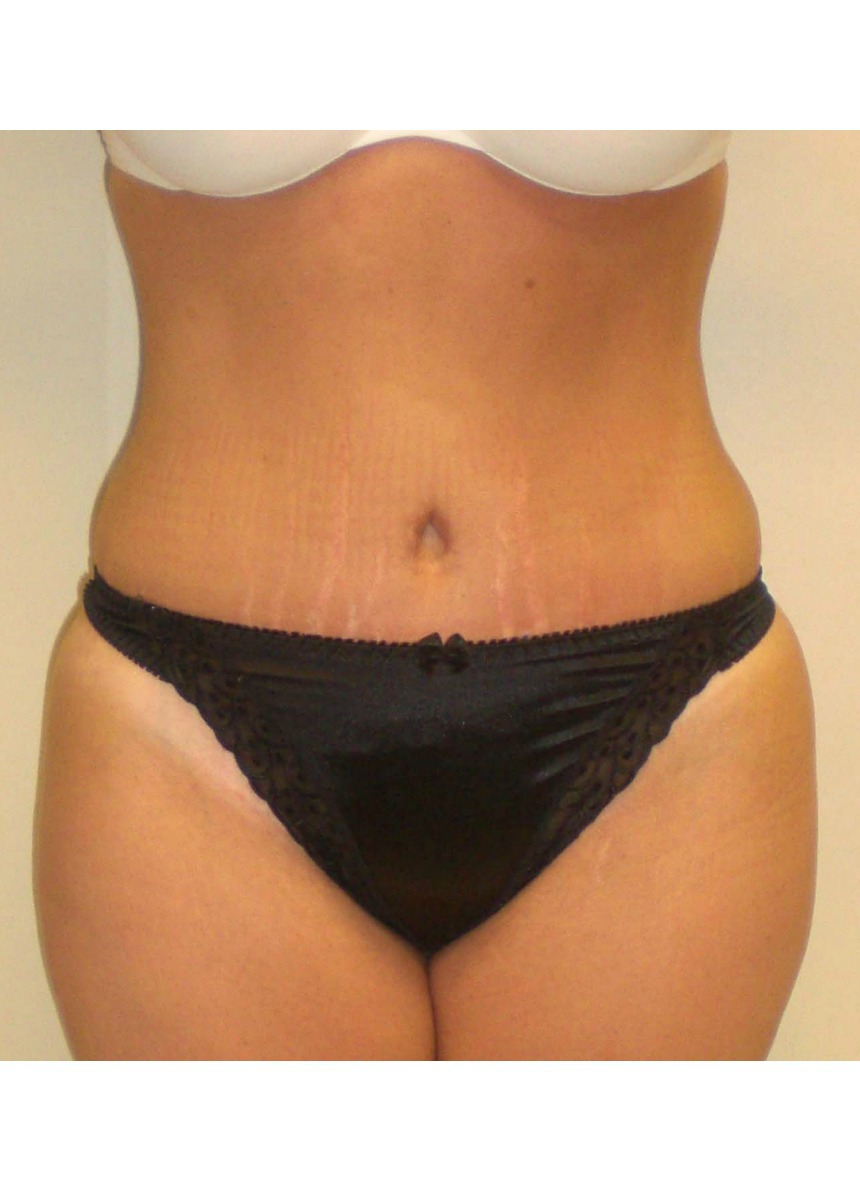 After Image