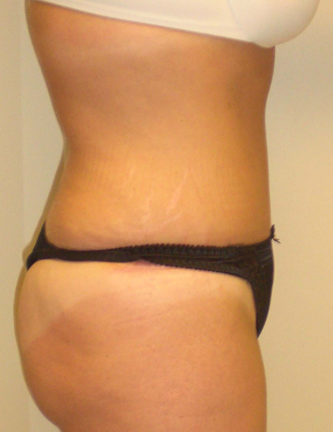 After Image