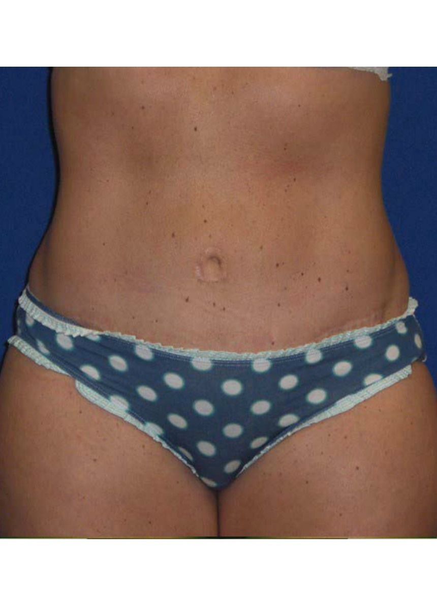 After Image