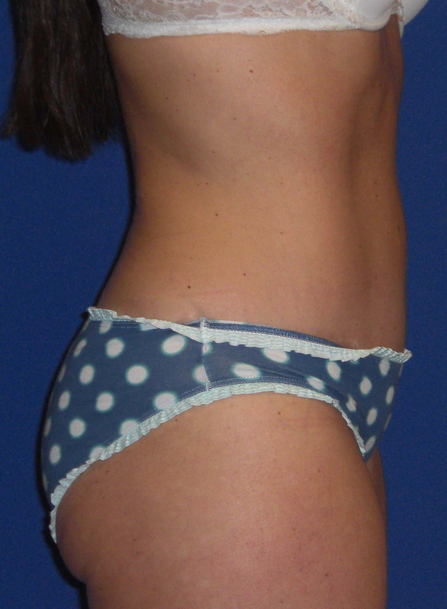 After Image