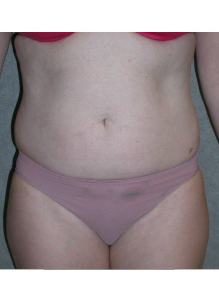 Before Image
